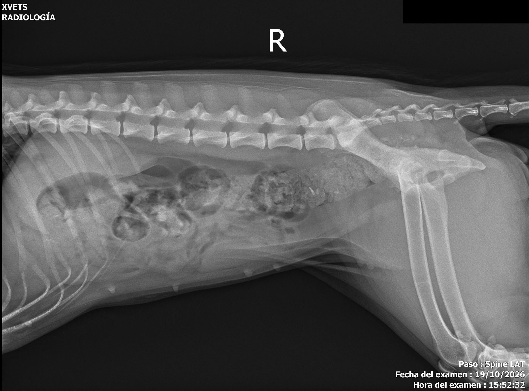 Radiografía original de la región lumbar en proyección lateral