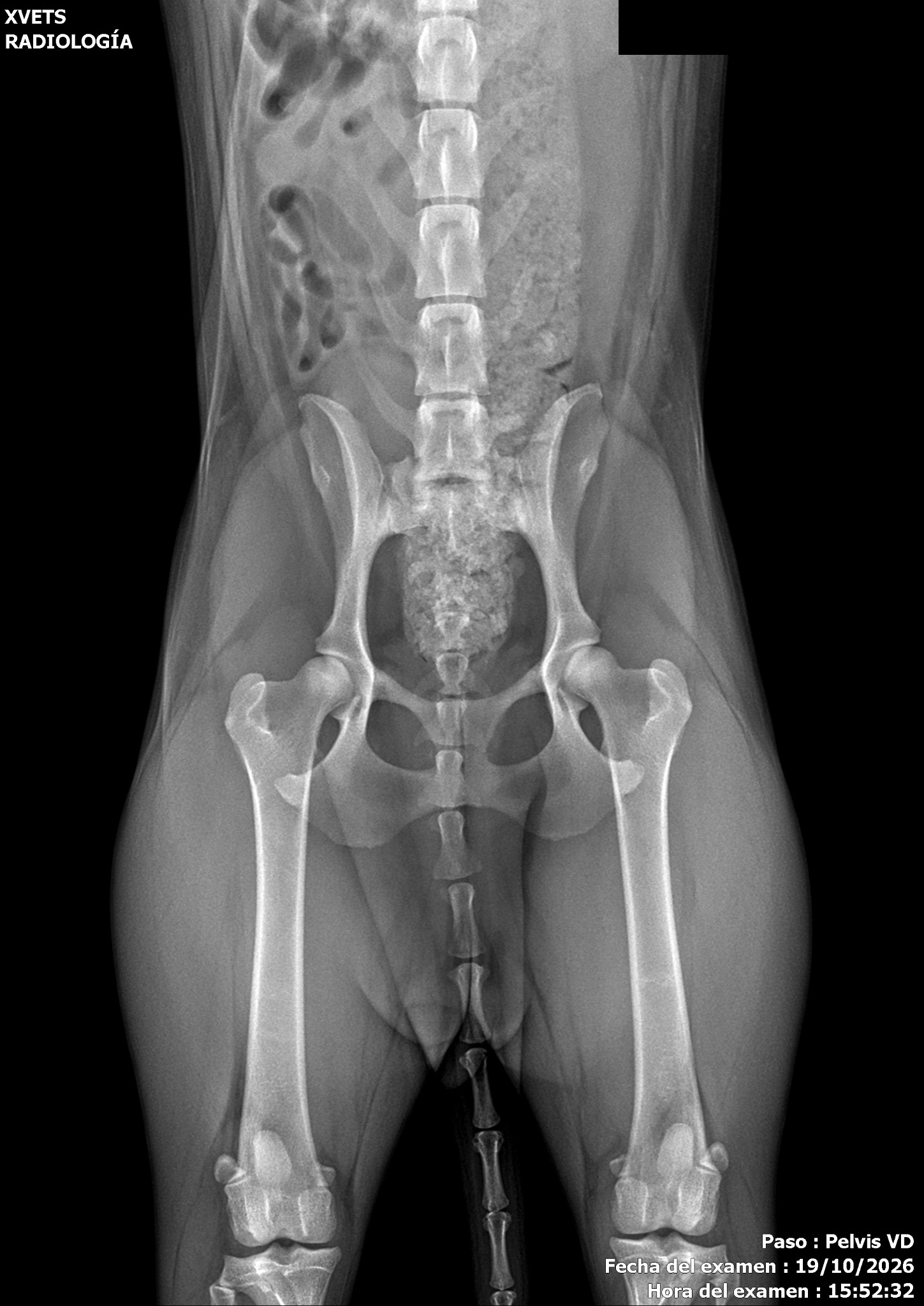 Radiografía original de pelvis en proyección ventrodorsal