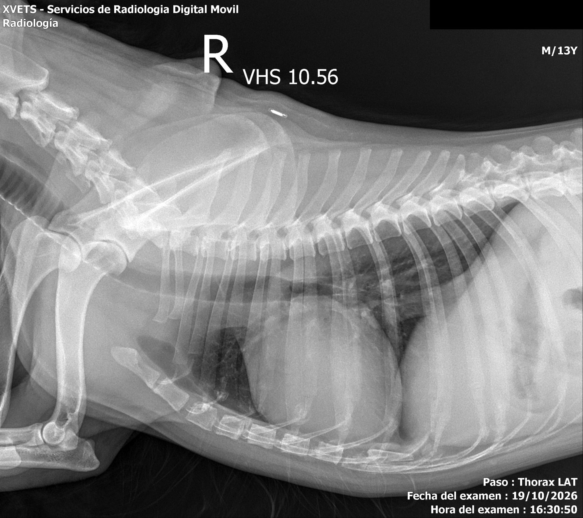 Radiografía original de tórax en proyección lateral